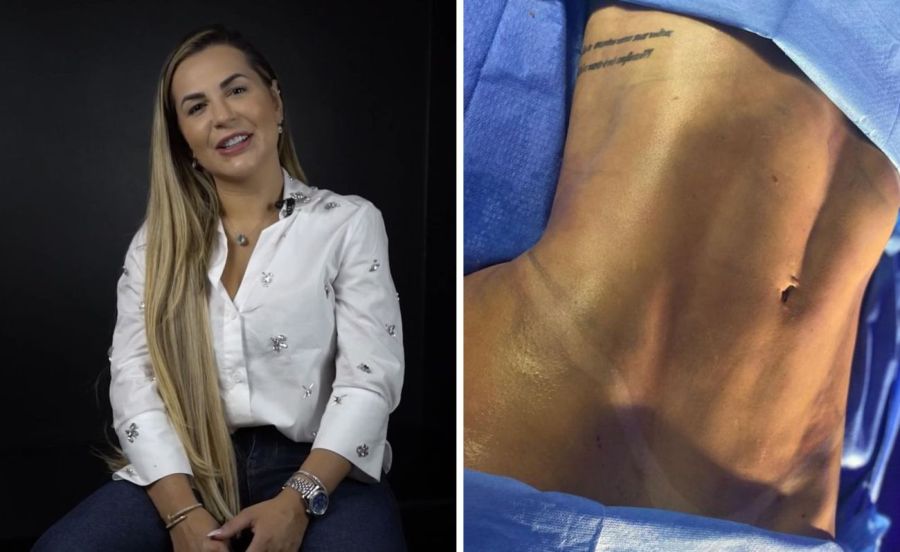 Deolane Bezerra na Clínica JK Estética Avançada - Foto: Divulgação